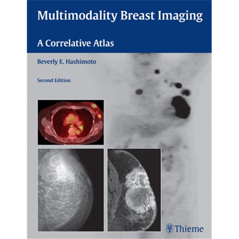 Multimodality Breast Imaging